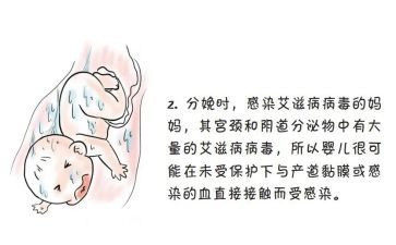 防艾活动的活动总结6篇